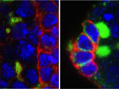 Microscopía de las células madre germinales (verde) del ovario de Drosophila de las moscas que carecen de EXD2. Las moscas en el panel derecho fueron tratadas con antioxidantes para rescatar las células madre. Imagen: Travis Stracker, IRB Barcelona.