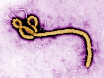 Virus del Ébola. Imagen: Frederick A. Murphy. Center for Disease Control and Prevention, National Institute of Health, EEUU.