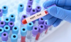 El NIPT es una prueba que analiza el ADN de origen fetal en la sangre materna