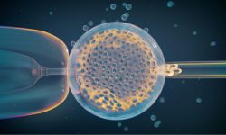 Biopsia de un embrión obtenido por fecundación in vitro. El análisis de miles de estos embriones ha permitido identificar variantes genéticas relacionadas con anomalías cromosómicas y aborto espontáneo. Imagen: Thom Leach, Amoeba Studios
