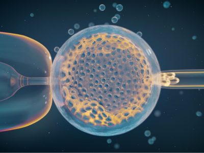 Biopsia de un embrión obtenido por fecundación in vitro. El análisis de miles de estos embriones ha permitido identificar variantes genéticas relacionadas con anomalías cromosómicas y aborto espontáneo. Imagen: Thom Leach, Amoeba Studios