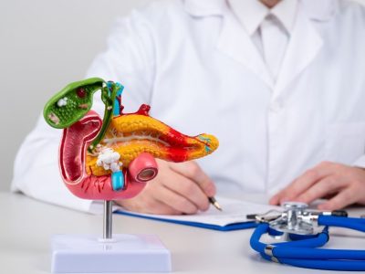 El cáncer de páncreas suele diagnosticarse de forma tardía, lo que repercute en un peor pronóstico.