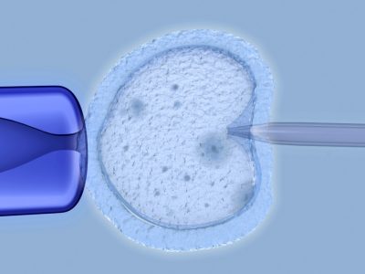 El esperma de un donante con una mutación de riesgo para el cáncer ha sido utilizado para concebir al menos 197 bebés en Europa