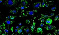 El fármaco AP-2 para la ELA comenzará a ser evaluado en abril
