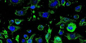El fármaco AP-2 para la ELA comenzará a ser evaluado en abril