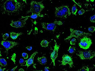 El fármaco AP-2 para la ELA comenzará a ser evaluado en abril
