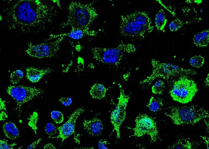 El fármaco AP-2 para la ELA comenzará a ser evaluado en abril
