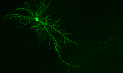 Neuronas de ratón sanas en el hipocampo. Cuando el microexón de nueve letras se excluye de la proteína DAAM1, las neuronas forman menos conexiones con otras células. Crédito: Patryk Poliński/Centro de Regulación Genómica.