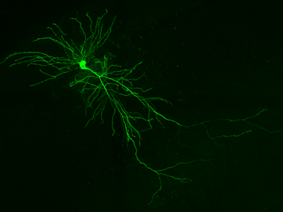 Neuronas de ratón sanas en el hipocampo. Cuando el microexón de nueve letras se excluye de la proteína DAAM1, las neuronas forman menos conexiones con otras células. Crédito: Patryk Poliński/Centro de Regulación Genómica.