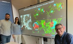 De izquierda a derecha: el Dr. Santiago López-Begines y la Dra. Nozha Borjini, junto con el director del estudio, el Prof. Rafael Fernández-Chacón, presentan las principales características patológicas observadas en el modelo murino de la enfermedad de Kufs/CLN4.