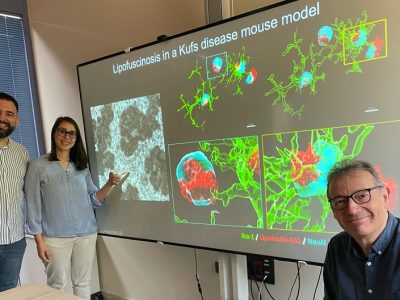 De izquierda a derecha: el Dr. Santiago López-Begines y la Dra. Nozha Borjini, junto con el director del estudio, el Prof. Rafael Fernández-Chacón, presentan las principales características patológicas observadas en el modelo murino de la enfermedad de Kufs/CLN4.
