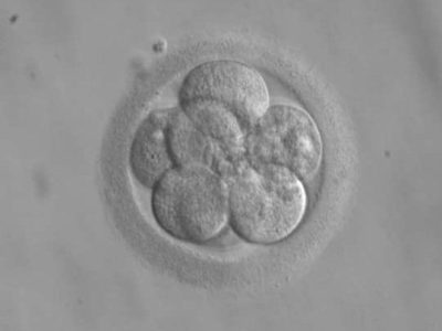 Embrión de 8 células. Imagen :By ekem, Courtesy: RWJMS IVF Program [Public domain], via Wikimedia Commons