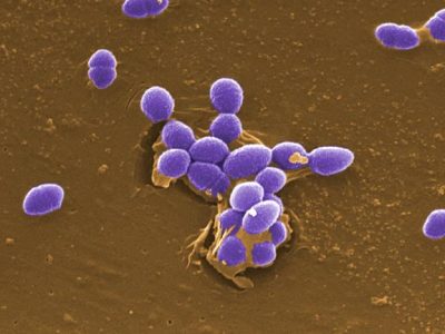 Enterococcus faecalis, una de las múltiples especies bacterianas que habita en el intestino humano. Imagen: Pete Wardell. Center for Disease Control and Prevention, National Institute of Health, EEUU.