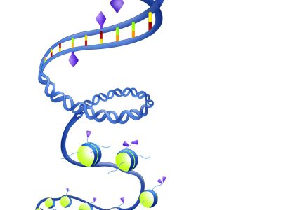Los resultados del trabajo apuntan a la posibilidad futura de utilizar marcadores epigenéticos para estimar la progresión del sarcoma de Ewing. Imagen: National Institute of General Medical Sciences.