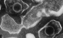 Viriones de Epstein-Barr. Imagen: De Liza Gross - (2005) Virus Proteins Prevent Cell Suicide Long Enough to Establish Latent Infection. PLoS Biol 3(12): e430 DOI: 10.1371/journal.pbio.0030430http://biology.plosjournals.org/perlserv?request=get-document&doi=10.1371/journal.pbio.0030430, CC BY 2.5)
