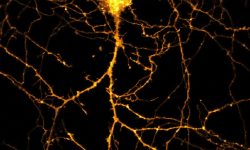 Expresión de la proteína H-Ras en una neurona del hipocampo. Imagen: J.A. Esteban