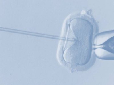 La edición del genoma en embriones plantea numerosas cuestiones técnicas, éticas, sociales y legales.