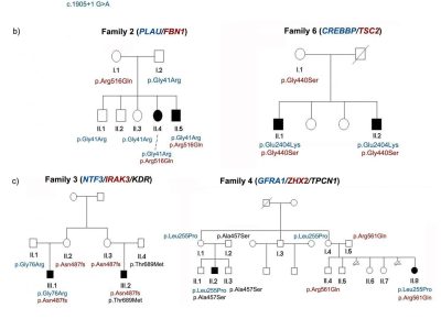 Árboles genealógicos de las ocho familias incluidas en el estudio. Se representan con diferentes colores los genes identificados que pueden explicar el fenotipo en cada familia y sus correspondientes variantes. Luzón-Toro B, et al. Exome sequencing reveals a high genetic heterogeneity on familial Hirschsprung disease. Sci Rep. 2015 Nov 12;5:16473. doi: 10.1038/srep16473.