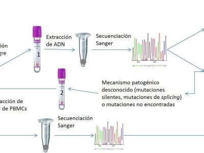 Metodología propuesta por los autores para el diagnóstico genético de la enfermedad de McArdle basada en el estudio del ARN en PBMCs. Imagen cortesía de los autores.