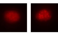 A la izquierda, célula de la sangre de un paciente con anemia de Fanconi antes de la corrección mediante el uso del sistema CRISPR/Cas9. A la derecha, la célula ya corregida. Se observa cómo se repara la función de la ruta de la anemia de Fanconi. Imagen: CIBERER.