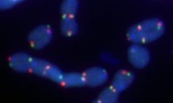 Fusiones de cromosomas a través de sus telómeros dependientes de la ADN polimerasa θ. En azul, cromosomas; en rojo y verde, telómeros.   Imagen: Pedro A. Mateos-Gómez (Skirball Institute of Biomolecular Medicine, Department of Cell Biology, NYU School of Medicine, New York)