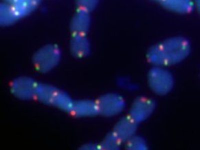 Fusiones de cromosomas a través de sus telómeros dependientes de la ADN polimerasa θ. En azul, cromosomas; en rojo y verde, telómeros.   Imagen: Pedro A. Mateos-Gómez (Skirball Institute of Biomolecular Medicine, Department of Cell Biology, NYU School of Medicine, New York)