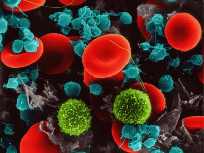 Los linfocitos tienen una función esencial para el correcto funcionamiento del sistema inmunitario. Imagen: Science Photo Library, vía Canva.