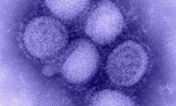 Virus de la gripe. Imagen: "H1N1 influenza virus" by CDC Influenza Laboratory.