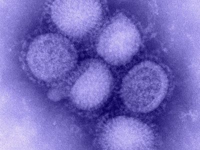Virus de la gripe. Imagen: "H1N1 influenza virus" by CDC Influenza Laboratory.