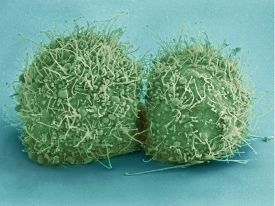 Bioingenieros del MIT han desarrollado una herramienta molecular que permite almacenar estímulos moleculares en forma de mutaciones dentro del genoma de células humanas. Imagen: National Institute of Health, EEUU.