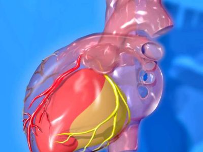 Los resultados indican que variantes genéticas que afectan al metabolismo de la glucosa aumentan el riesgo de enfermedad coronaria. Imagen: Territorios del corazón, Patrick J. Lynch, ilustrador médico, [CC-BY-2.5 (http://creativecommons.org/licenses/by/2.5)].