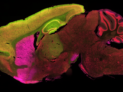 Imagen del cerebro de un ratón. La enfermedad de Huntington ataca especialmente a las células del córtex (en amarillo) y las del estriado (en rosa). Imagen: UCLA.