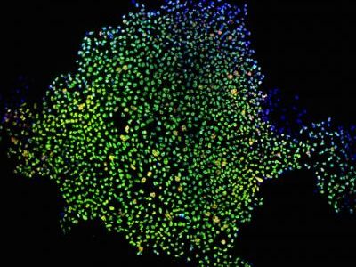 Células madre pluripotentes inducidas (células adultas de la piel que han sido reprogramadas genéticamente para tener características de células madre embrionarias).  Imagen: James Thomson, University of Wisconsin-Madison.