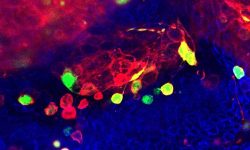La activación de las caspasas apoptóticas (en verde) en células con altos niveles de inestabilidad cromosómica (en rojo) juega un papel fundamental en la invasividad del tejido. Imagen: Dr. Mariana Muzzopappa, IRB Barcelona.
