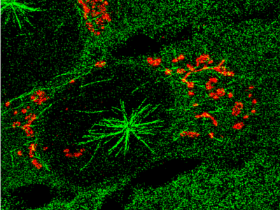 Imagen de microscopía de células humanas con microtúbulos (en verde) que crecen desde el centrosoma y desde el aparato de Golgi (marcado en rojo). Imagen: IRB Barcelona.