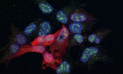 Células donde se estudia una proteína (en verde) implicada en la metástasis del cáncer de mama Imagen: Alicia Llorente, IRB Barcelona.