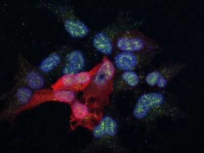 Células donde se estudia una proteína (en verde) implicada en la metástasis del cáncer de mama Imagen: Alicia Llorente, IRB Barcelona.