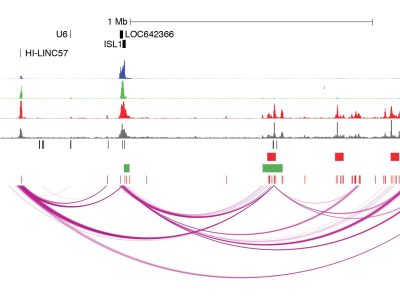 Mapas tridimensionales del genoma creados en células del páncreas humano, donde los arcos de color rosa simbolizan los contactos entre zonas alejadas del ADN.
