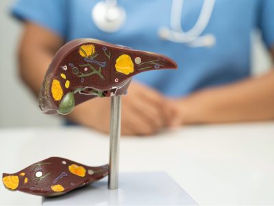 El estudio revela el papel de la ruta de TGF-B e identifica dos nuevas dianas terapéuticas para el colangiocarcinoma.