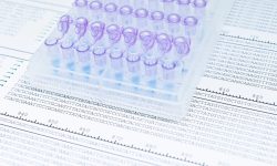 Conectan variación genética en genes del metabolismo del colesterol con la predisposición al síndrome de distrés respiratorio agudo