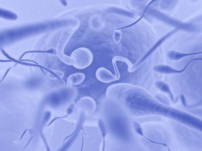 Identifican un donante de esperma portador de una mutación de riesgo a desarrollar cáncer y descendientes afectados. Imagen: Adobe Express.