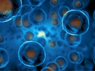 Identifican un nuevo mecanismo que promueve metástasis del cáncer