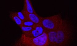 Células humanas de cáncer de pulmón con la mutación L858R en el gen EGFR. Los núcleos celulares se muestran en azul y en rojo se marca una proteína presente en el citoplasma cuando la proteína EGFR está activa y dirige divisiones celulares descontroladas. Imagen: Instituto Weizmann.
