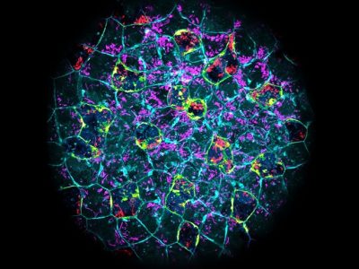 Los embriones pueden eliminar infecciones bacterianas incluso antes de tener un sistema inmunitario desarrollado. Imagen: embrión de pez cebra con bacterias E. coli ingeridas (rojo y magenta), Joan Roncero-Carol . CSIC
