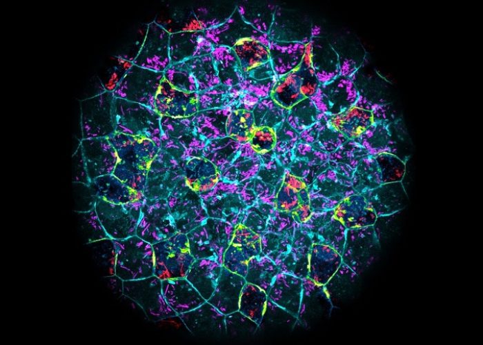 Los embriones pueden eliminar infecciones bacterianas incluso antes de tener un sistema inmunitario desarrollado. Imagen: embrión de pez cebra con bacterias E. coli ingeridas (rojo y magenta), Joan Roncero-Carol . CSIC