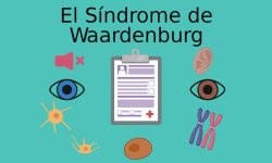 Síndrome de Waardenburg