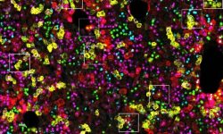 iFlpMosaics representa un gran avance para los investigadores que estudian enfermedades causadas por mutaciones somáticas