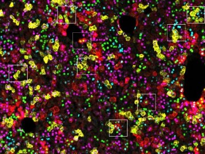 iFlpMosaics representa un gran avance para los investigadores que estudian enfermedades causadas por mutaciones somáticas