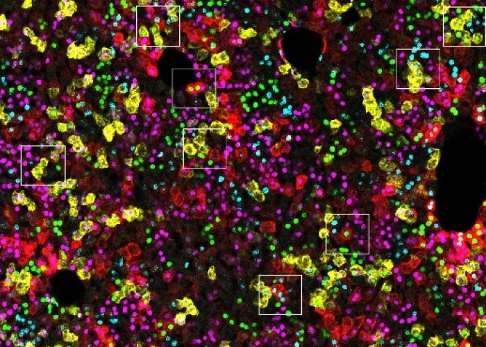 iFlpMosaics representa un gran avance para los investigadores que estudian enfermedades causadas por mutaciones somáticas