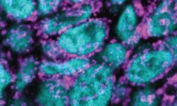 Figura 1. El análisis por microscopia confocal de células madre en cultivo revela que poseen una red mitocondrial fragmentada (cian, factor nuclear Oct4 de células madre; magenta, mitocondrias). Imagen cortesía de los autores.